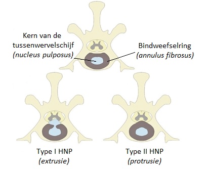 Hernia hond