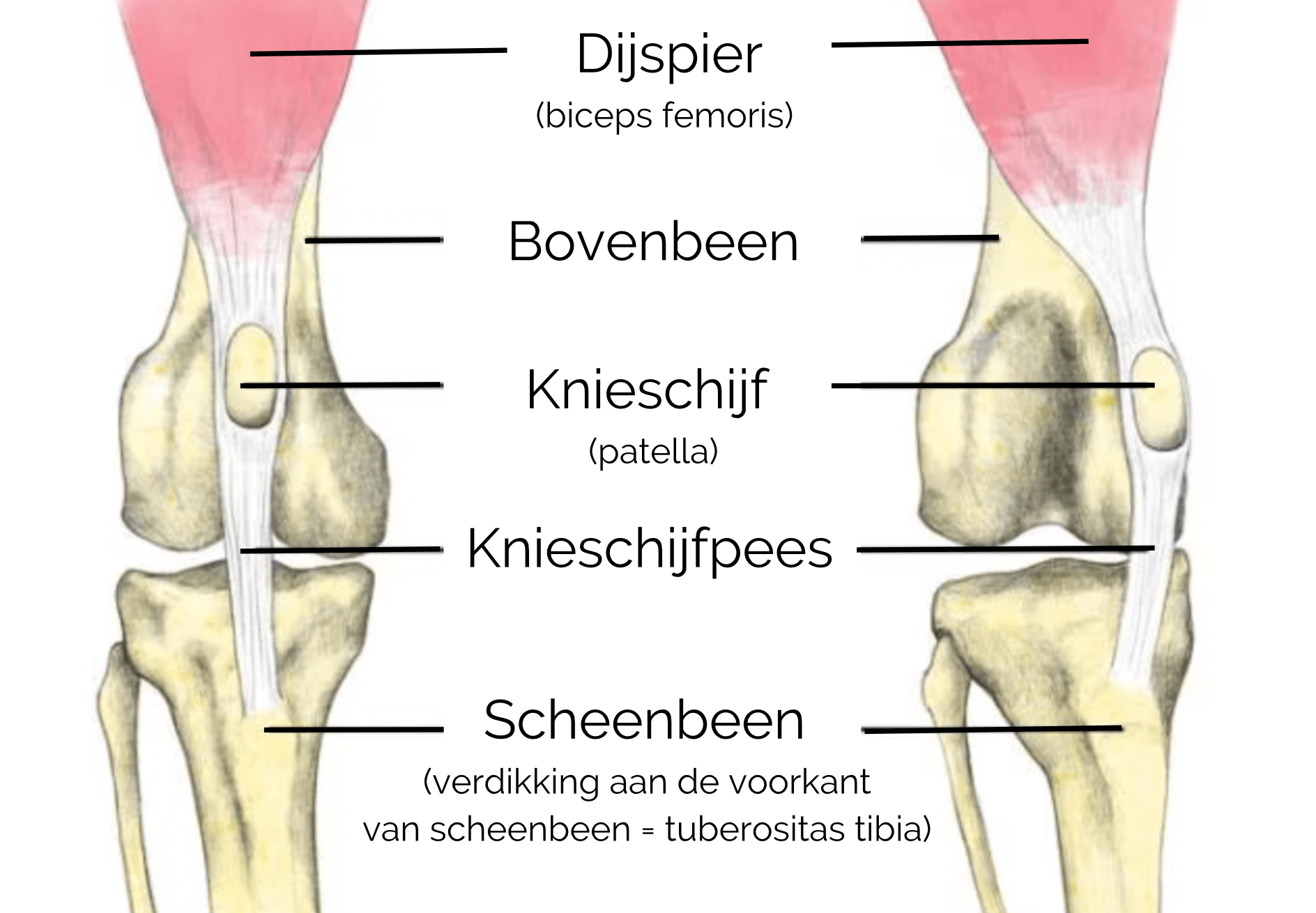 Patellaluxatie bij de hond