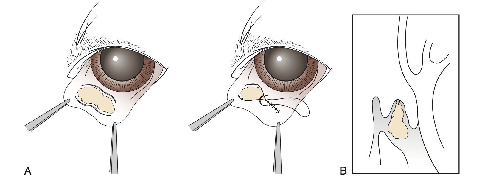 Cherry eye bij de hond - operatie